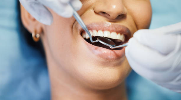 Best Emergency Treatment for Dental Infections or Abscesses in Bullhead City, AZ